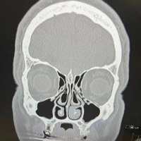 Dr Pouldeau (@michaelandre81) 's Twitter Profile Photo