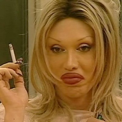 peteburnsalive Profile Picture