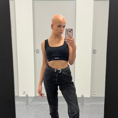 Life with Alopecia 👩🏼‍🦲 Artist. Jeweller. WEAR YOUR DIFFERENCES