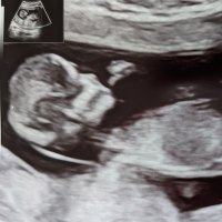 My Name Is Human (@lifeworthyflife) 's Twitter Profile