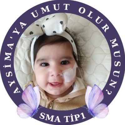 Merhaba, Aysima DURMUŞ Sma Tip-1 Kas hastası 🦋 Her türlü maddi ve manevi desteğinize ihtiyacı var.✨ https://t.co/n4H6NrYNgq