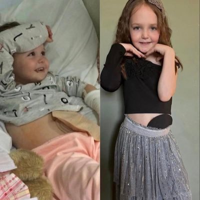 Jessica is 9 years old she has a colostomy stoma since age 4 she promotes positive stoma awareness and raises money for charity, page run by her mum @kimlucock