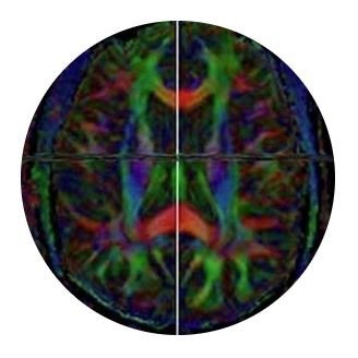 Physician-scientist in neuro-oncology @MDAndersonNews. Lab studies biophysical energy against cancer,  cancer-neuronal interactions, and advanced neuroimaging.