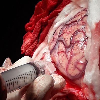 yashargil1996's profile picture. سرجیکال تک