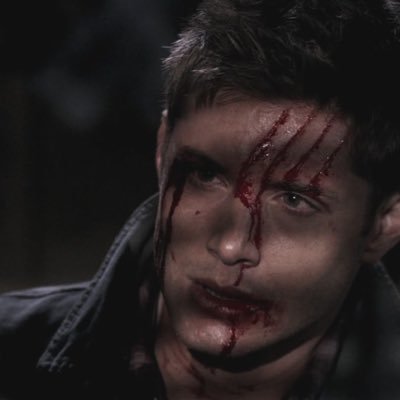 #DEAN: the most caring man on earth