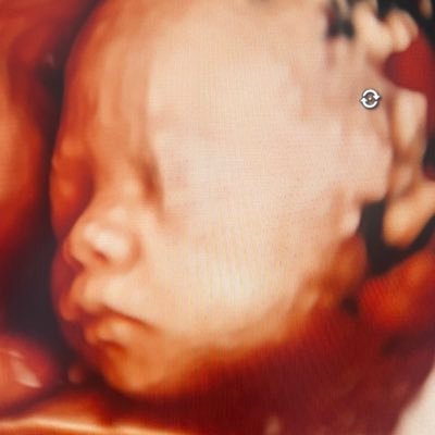 zipzop0205's profile picture. 