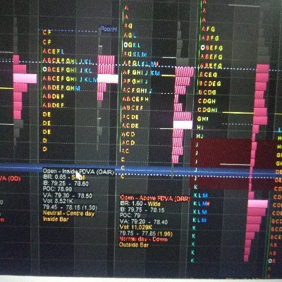 BANKNIFTY Trader. AVWAP OPTIONS CHAINS ANALYST. Demand Zone/Supply Zone. Longtime Investment. Swing Trading and Scalping strategies. Options selling strategies