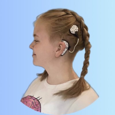 🦻🏻18yo profoundly Deaf and autistic 🎥 BBC The Social Content Creator 💙 Advanced Bionics Mentor 🎬 Instagram - cochlearkaz