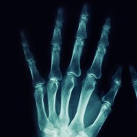 Radiologia verde / Green Radiology (@radiologiaverde) 's Twitter Profile