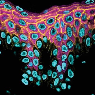 Illuminating keratinocyte cell biology @DermatologyUW to understand epidermal differentiation/tissue homeostasis and how they are compromised in skin disease.