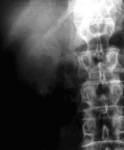 object74's profile picture. sharp little object has just withdrawn from heroin use!