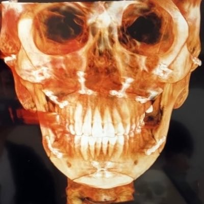 yao_biyou's profile picture. スマホに残したくない整形記録をxに書いています。23/09両顎輪郭3点、24/04ピン除去、25/11鼻フル人中短縮