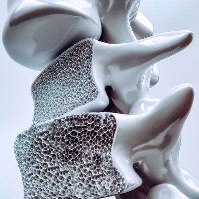 Academic Physicians with diverse specialties, all sharing a keen interest in Osteoporosis