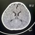 Neurocríticos 🧠 (@neurocr_commec) Twitter profile photo Neurocríticos 🧠 (@neurocr_commec) Twitter profile photo