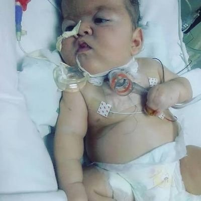 Meu filho nasceu com um pequeno tumor no lado esquerdo do cérebro e precisa ser operado o mais rápido possível.

PIX: pixhenrique123@gmail.com