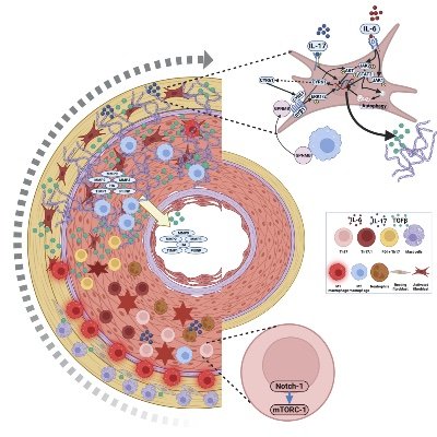 Posting articles related to Takayasu arteritis, a rare large vessel vasculitis that I am passionate about. Account run by @DurgaPrasannaM1