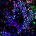 USTAN Imaging & AI (@molecularmicro) Twitter profile photo USTAN Imaging & AI (@molecularmicro) Twitter profile photo
