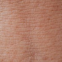 Dermatology Papers(@DermatologyPape) 's Twitter Profile Photo