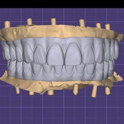 China Digital Dental Laboratory, you scan, I design.whatsapp:+8613128896974