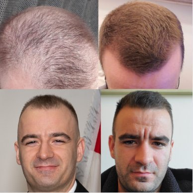 Hair Loss Expert | Do What Works | 15+ Years of Experience  | Minimum Effective Doser