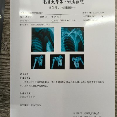 代开医院真实病假条、代开医院证明、代开怀孕证明、英文工作证明、英文体检报告、体检报告、开具诊断证明、病假理由大量专业提供 代开医院病例证明、怀孕证明、门诊收据、病历手册、化验单、CT报告单、开药处方单、病假条、诊断证明书、门诊、急诊病假条等等。#英文病假条 #抑郁证明英文 微：kbjt234