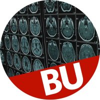Center for Brain Recovery(@AphasiaLab) 's Twitter Profile Photo