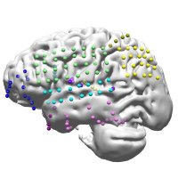 CHLA Epilepsy Fellowship (@chlaepilepsy) 's Twitter Profile