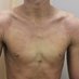 Atopic Derm and Developmental Disorders/HSP are… (@atopicdermworld) Twitter profile photo Atopic Derm and Developmental Disorders/HSP are… (@atopicdermworld) Twitter profile photo