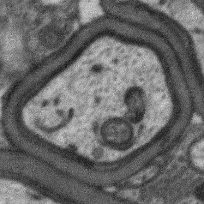 PhD student in Simons Lab @TU_Muenchen studying membrane biology of myelin 💗#CellBio #microscopy //formerly @ScienceStowers @dartmouth