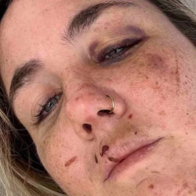gofundme for Susan after she was brutally beaten, raped, strangled, and left for dead in the jungle by a taxi driver in Tulum, Mexico last Monday, December 18.