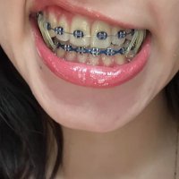 braces and anal(@brace_urself_) 's Twitter Profile Photo