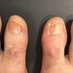 MyUglyFeetAUS (@myuglyfeetaus) Twitter profile photo MyUglyFeetAUS (@myuglyfeetaus) Twitter profile photo