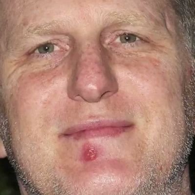 HerpesRapaport Profile Picture