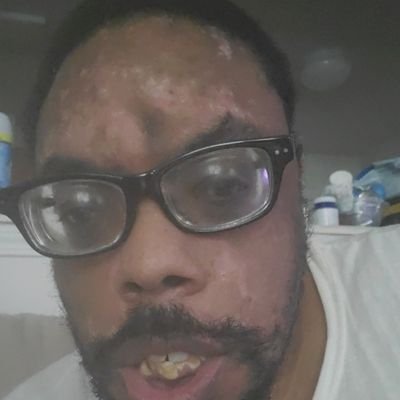 Just chillin. 37 years old. Disabled, but educated.