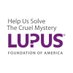 LupusPDVregion (@lupuspdvregion) Twitter profile photo LupusPDVregion (@lupuspdvregion) Twitter profile photo