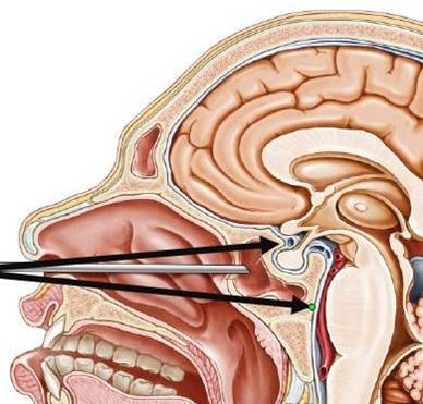 Consultant Neurosurgeon | Skull base and Pituitary | University Hospital of Wales | Neurosurgery MSc with @diplomamsc | Professor