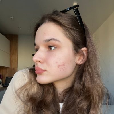 AlinaZubova3's profile picture. і зійде сонце над вільним Донбасом