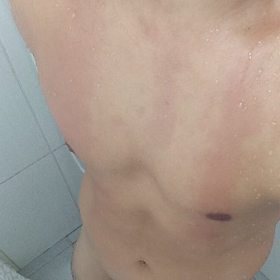 pode chama na dm ja com foto 
retribuo
sigilo total 
somente mulheres