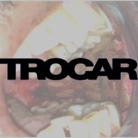 trocar(@thetrocar) 's Twitter Profile Photo