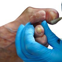 footcare2024's profile picture. North london foot care provides mobile feet care services in london, ontario. Specializing in the care of diabetic foot, corns, calluses, and so on.