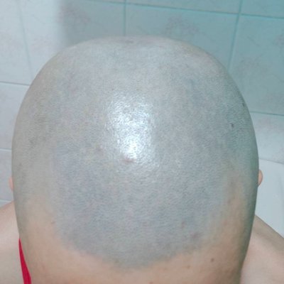 : Bald choice | Bd$M | Slave | Ff | 🏳️‍🌈
:looking for master 
:training, control , order ,shaving my head
32y
