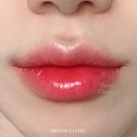 MOON CLINIC (ムーンクリニック) 韓国 문클리닉(@moonclinic_kr) 's Twitter Profileg