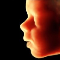 ScanBaby Baby Ultrasound for Moms(@ScanBabyApp) 's Twitter Profile Photo