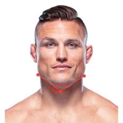 Every human chin is unique in its size and shape. However, in every case it can only take so much damage. Founder of the ACR👊#ChinCollectorOfTheWeek #DuraChin