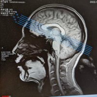 cognitive enhancement enthusiast(人間の知能増強) (@kaedaej) 's Twitter Profile