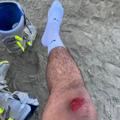 La clave de un jugador admirable, no es ganar todos los partidos, es jugar lo mejor que sabe sin importar el resultado final, al final, no está bajo su control