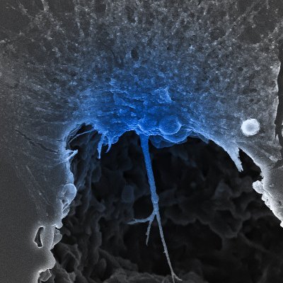 Biomaterials for theranostic applications
@CanalUGR