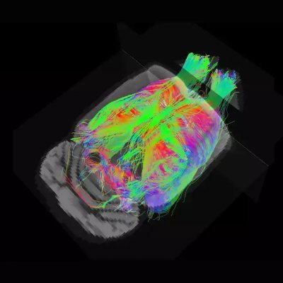 MRI-based functional & structural connectivity, brain resilience, Alzheimer's disease. Multidisciplinary team, PI:  Guadalupe Soria at @UBneurosciences