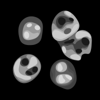 vasculitides (@vasculitides) 's Twitter Profile