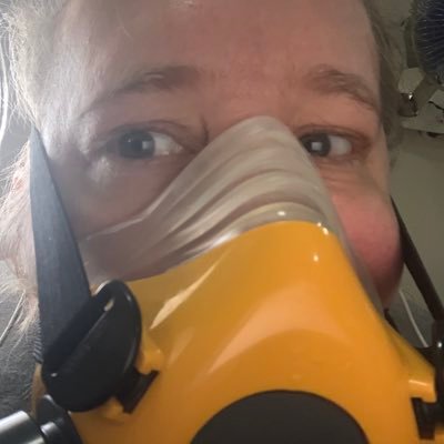 longcovidisreal's profile picture. Covid Mar 2020 had long covid ever since! POTS+slow blood flow in left IJV+poor gas exchange+myocarditis +MCAS+gastric anaphylaxis+menopause at 41+I’m bendy!